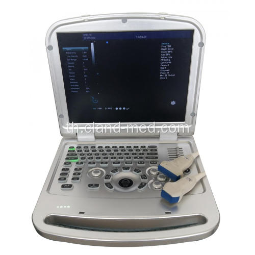 แล็ปท็อปที่มีคุณภาพสูง 4d แบบพกพาสี Doppler เครื่องอัลตราซาวด์